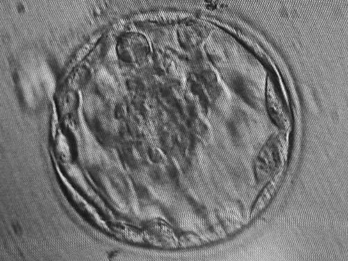 A blastocyst: a fluid-filled cavity and an inner cell mass