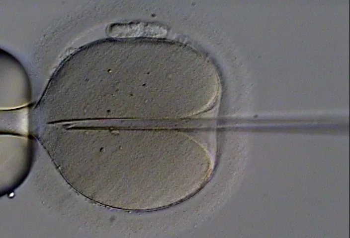 ICSI: the holding pipette and the fine needle at the egg